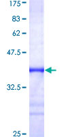 SDS-PAGE - Recombinant Human FXR1 protein (AB152840), expandable thumbnail