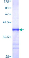 SDS-PAGE - Recombinant Human FXR1 protein (AB152840)