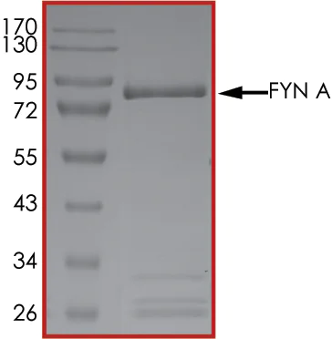 SDS-PAGE - Recombinant human Fyn protein (AB84696)