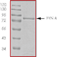 SDS-PAGE - Recombinant human Fyn protein (AB84696), expandable thumbnail