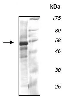 SDS-PAGE - Recombinant human Fyn protein (DDDDK tag N-Terminus) (AB135007)