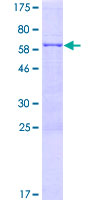SDS-PAGE - Recombinant Human FYTTD1 protein (GST tag N-Terminus) (AB164533)
