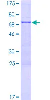 SDS-PAGE - Recombinant Human FYTTD1 protein (GST tag N-Terminus) (AB164533)