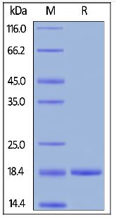 SDS-PAGE - Recombinant human G-CSF protein (AB167700), expandable thumbnail