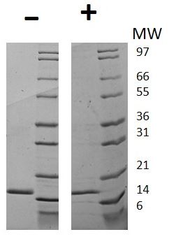 Recombinant human G-CSF protein (Active)