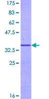 SDS-PAGE - Recombinant Human G0/G1switch 2/G0S2 protein (AB162338)