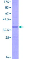 SDS-PAGE - Recombinant Human G0/G1switch 2/G0S2 protein (GST tag N-Terminus) (AB162338)