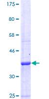SDS-PAGE - Recombinant Human GABA B Receptor 1 protein (AB112287)