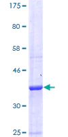 SDS-PAGE - Recombinant Human GABA B Receptor 1 protein (AB112287)