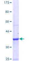 SDS-PAGE - Recombinant Human GABA B Receptor 1 protein (GST tag N-Terminus) (AB112287)