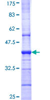 SDS-PAGE - Recombinant Human GABRB1 protein (GST tag N-Terminus) (AB152415)
