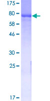 Recombinant Human GAD65 protein