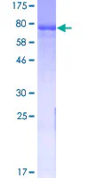 SDS-PAGE - Recombinant Human GAD65 protein (AB114208)