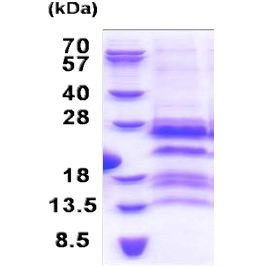 SDS-PAGE - Recombinant Human GAGE12F protein (AB171486), expandable thumbnail