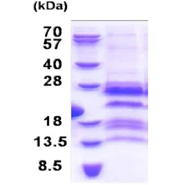 SDS-PAGE - Recombinant Human GAGE12F protein (His tag N-Terminus) (AB171486)