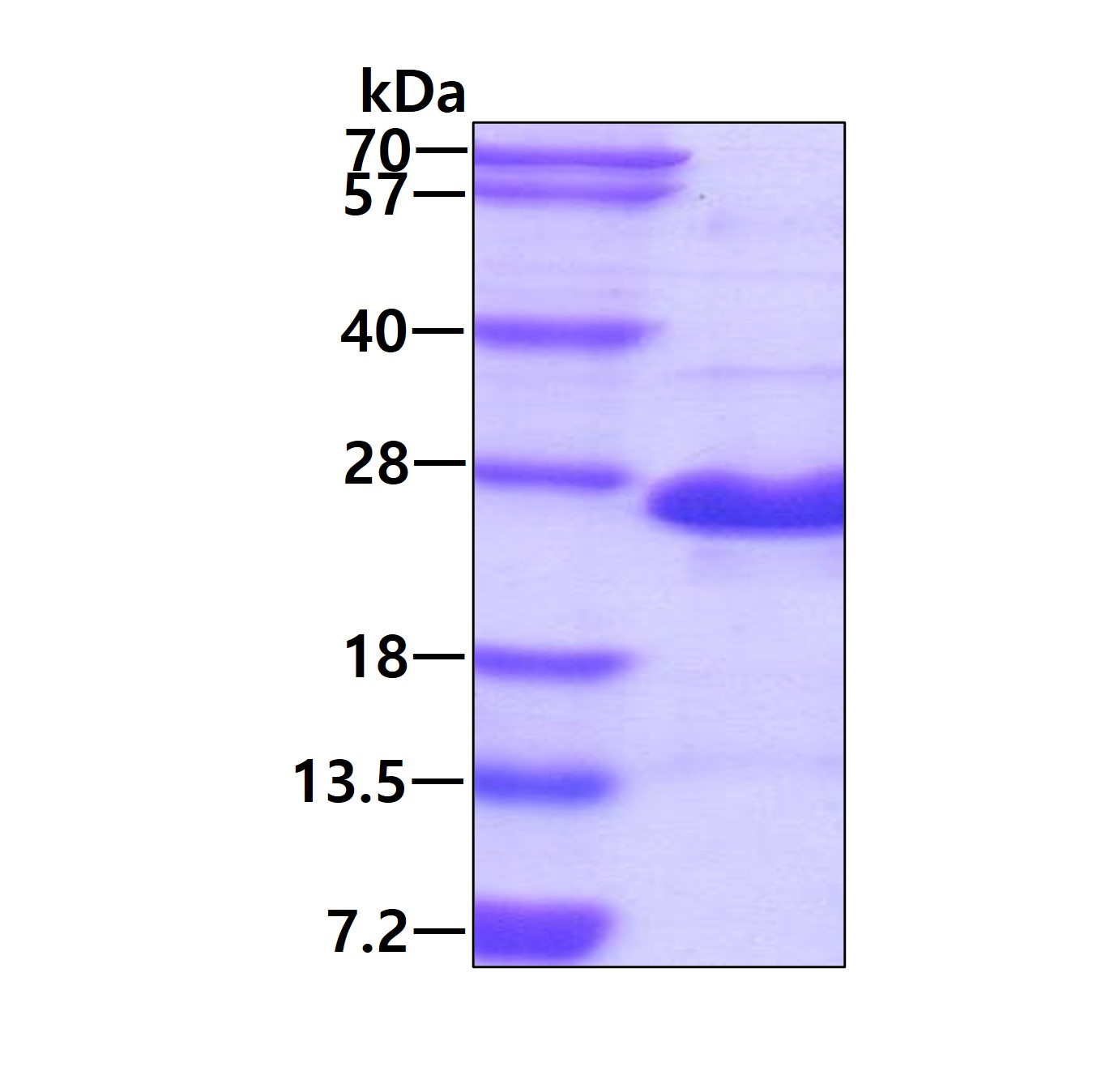 SDS-PAGE - Recombinant Human GAGE2A protein (His tag N-Terminus) (AB171690)
