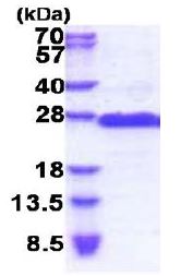 SDS-PAGE - Recombinant Human GAGE2D protein (His tag N-Terminus) (AB171480)