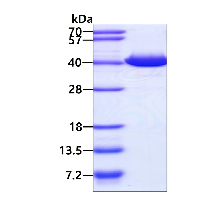 SDS-PAGE - Recombinant Human GALE protein (AB96767)