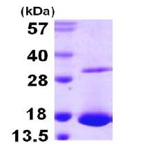 SDS-PAGE - Recombinant Human Galectin 10 protein (AB107951)