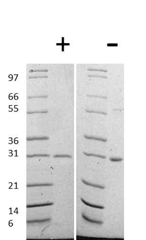 Western blot - Recombinant human Galectin 3 protein (AB78583)