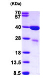 Recombinant Human Galectin 8/Gal-8 protein