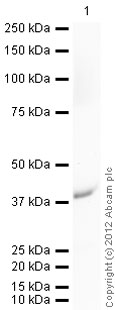 Western blot - Recombinant Human Galectin 8/Gal-8 protein (His tag N-Terminus) (AB99294)
