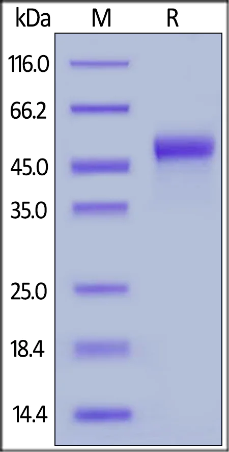 SDS-PAGE - Recombinant Human galectin 9/Gal-9 protein (His tag) (AB221022)