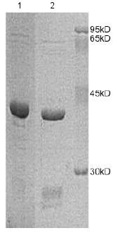 SDS-PAGE - Recombinant Human GALK1 protein (AB172152)