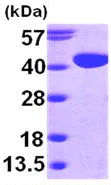 SDS-PAGE - Recombinant Human GALM protein (His tag N-Terminus) (AB98150)