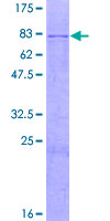 Recombinant Human GALNS/Chondroitinase protein
