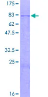 SDS-PAGE - Recombinant Human GALNS/Chondroitinase protein (GST tag N-Terminus) (AB158492)