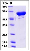 SDS-PAGE - Recombinant Human GALNT2 protein (His tag) (AB276585)