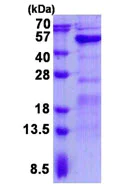 SDS-PAGE - Recombinant Human GALT protein (His tag N-Terminus) (AB139613)