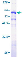 SDS-PAGE - Recombinant Human gamma Actin protein (AB157841), expandable thumbnail