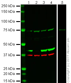Western blot - Recombinant Human gamma Actin protein (GST tag N-Terminus) (AB157841)