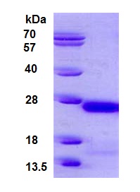 SDS-PAGE - Recombinant Human gamma C Crystallin protein (AB126922), expandable thumbnail