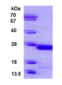 SDS-PAGE - Recombinant Human gamma C Crystallin protein (His tag N-Terminus) (AB126922)