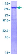 Recombinant Human gamma Catenin protein
