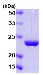 SDS-PAGE - Recombinant Human Gankyrin protein (AB78763)
