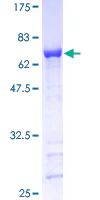 SDS-PAGE - Recombinant Human GAP43 protein (GST tag N-Terminus) (AB114188)