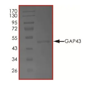 SDS-PAGE - Recombinant Human GAP43 protein (His tag) (AB268592)