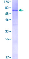 SDS-PAGE - Recombinant Human GAPDS protein (AB161972), expandable thumbnail