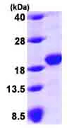 SDS-PAGE - Recombinant Human GAPR-1 protein (His tag N-Terminus) (AB99564)