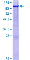 SDS-PAGE - Recombinant Human GAS 6 protein (AB131810)
