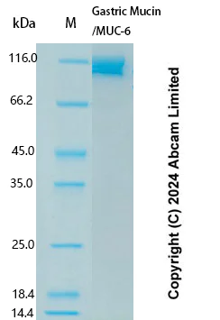 SDS-PAGE - Recombinant Human Gastric Mucin/MUC-6 Protein Standard (AB323125)
