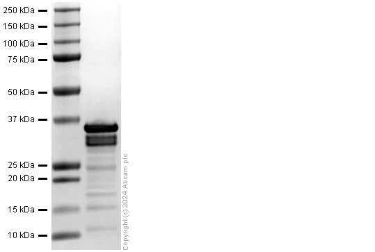SDS-PAGE - Recombinant Human Gastrin protein (His-tag) (AB322314)
