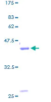 SDS-PAGE - Recombinant Human Gastrin Releasing Peptide protein (GST tag N-Terminus) (AB158593)