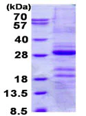 SDS-PAGE - Recombinant Human Gastrokine 1 protein (His tag N-Terminus) (AB131669)