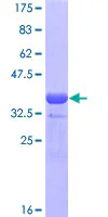 SDS-PAGE - Recombinant Human GATA4 protein (AB112289)