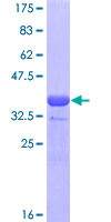 SDS-PAGE - Recombinant Human GATA4 protein (GST tag N-Terminus) (AB112289)